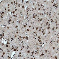 Anti-CACNG3 Antibody