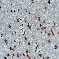 Anti-CACNG4 Antibody