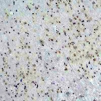 Anti-CACNG5 Antibody