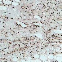 Anti-CALHM1 Antibody