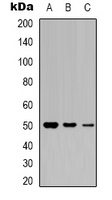 CCKBR Rabbit Polyclonal Antibody
