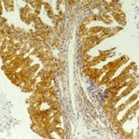 Anti-CD184 Antibody