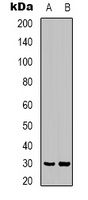 CLIC4 Antibody