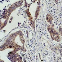Anti-c-RAF Antibody