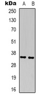 Cyclin D1 Rabbit Polyclonal Antibody