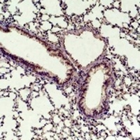 Cyclin D1 Rabbit Polyclonal Antibody