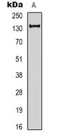 E Cadherin Antibody