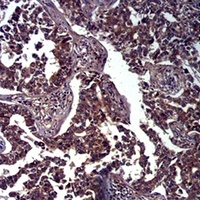 E Cadherin Antibody
