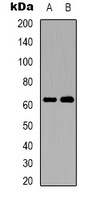 EAAT2 Rabbit Polyclonal Antibody