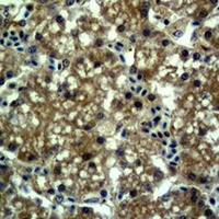 Anti-EPG5 Antibody