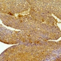 EPHA1 antibody