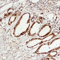 Anti-ERK3 Antibody
