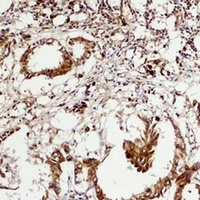 Anti-ERK5 Antibody