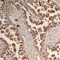 Flotillin 2 Rabbit Polyclonal Antibody