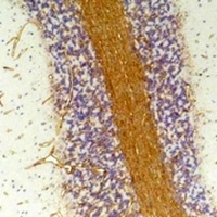 Anti-GABRA2 Antibody