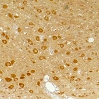 Anti-GABRA3 Antibody