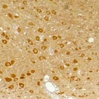 GABRA3 antibody