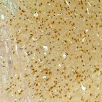 Anti-GABRA4 Antibody