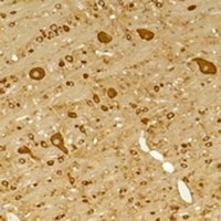 GABRG2 Rabbit Polyclonal Antibody