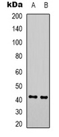 GALR2 Rabbit Polyclonal Antibody