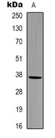 GAPDH Rabbit Polyclonal Antibody