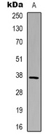 GAPDH Rabbit Polyclonal Antibody