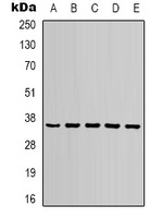 GAPDH Rabbit Polyclonal Antibody