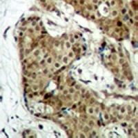GAPDH Rabbit Polyclonal Antibody