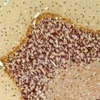 Anti-GAT1 Antibody