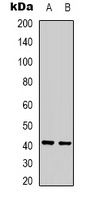 Ghrelin Receptor Rabbit Polyclonal Antibody