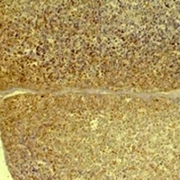 Anti-GLP-1 Receptor Antibody