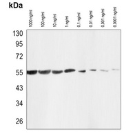 Anti-Beta-tubulin Antibody-HRP labled