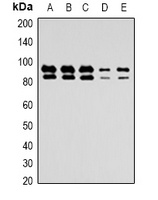 Glucocorticoid Receptor Rabbit Polyclonal Antibody