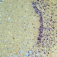 Anti-GLUR1 Antibody