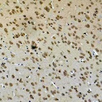 Anti-GLUR4 Antibody