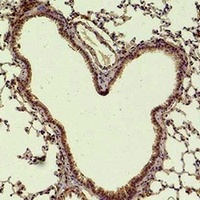 Anti-HAO1 Antibody