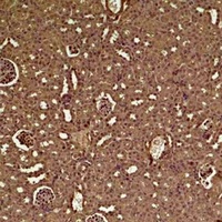 Anti-HIF1 alpha Antibody