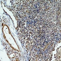 Anti-HIF1 beta Antibody