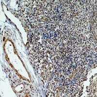 HIF1 beta antibody