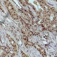 Anti-Histone H1 (DiMethyl-K25) Antibody
