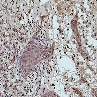 Anti-Histone H1 (MonoMethyl-K25) Antibody