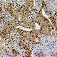 Anti-Histone H1 (Phospho-T17) Antibody