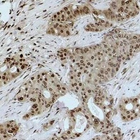 Histone H1 (TriMethyl-K25) Rabbit Polyclonal Antibody