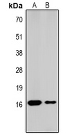 Histone H1 Rabbit Polyclonal Antibody