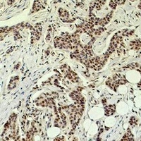 Histone H1 Rabbit Polyclonal Antibody