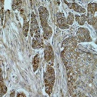 Histone H2A (Acetyl-K15) Antibody