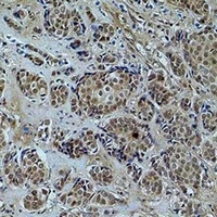 Histone H2A (Acetyl-K9) Rabbit Polyclonal Antibody