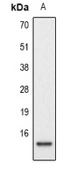 Histone H2A (Phospho-S129) Antibody