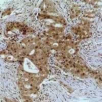 Histone H2A.X (Phospho-S139) antibody
