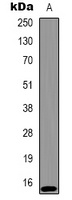 Histone H2A.X (Phospho-T120) Antibody